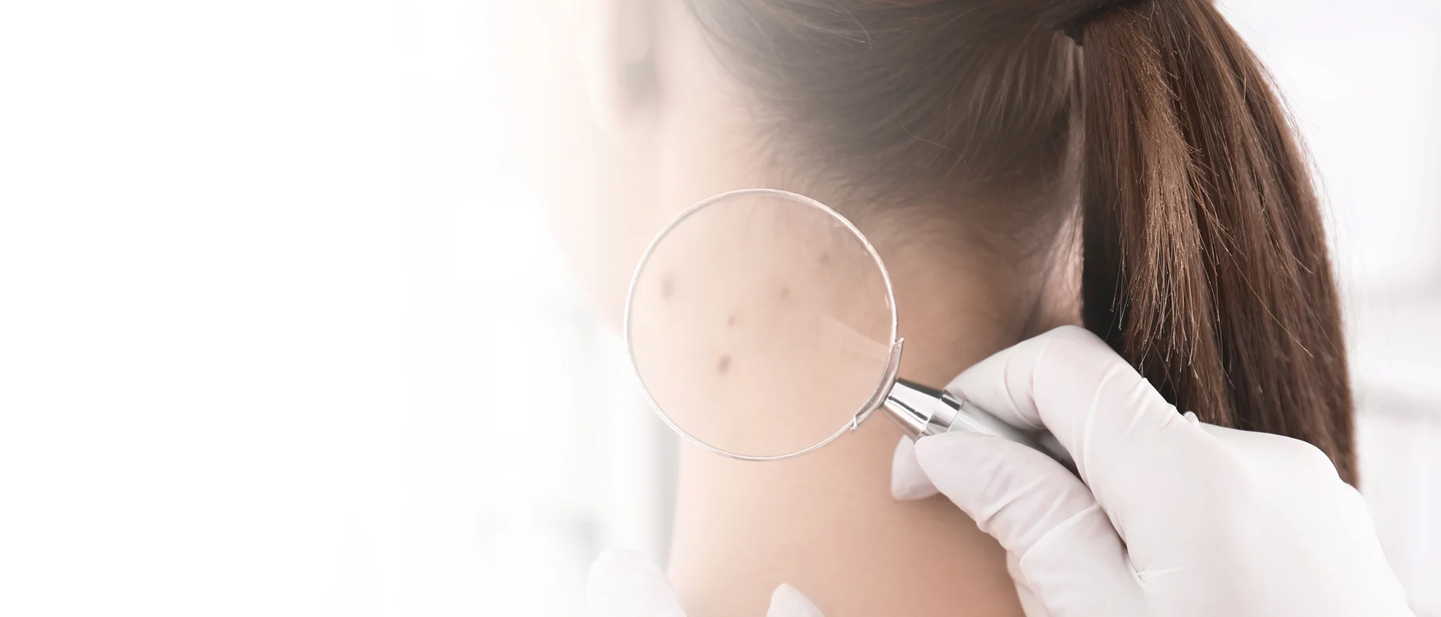 Dermatology